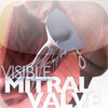 Visible Mitral