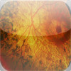 Retina Atlas