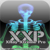 XRay Xtreme