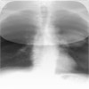 Pulmonary Review