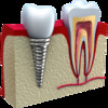 Simple Odontogram