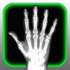 X-Ray Scanner HD for iPad