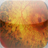 Retina Atlas HD